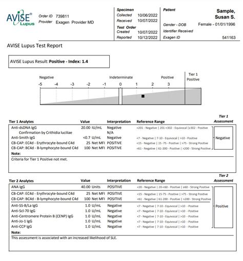 lupus blood test results|Lupus Blood Test Results: What to Know .